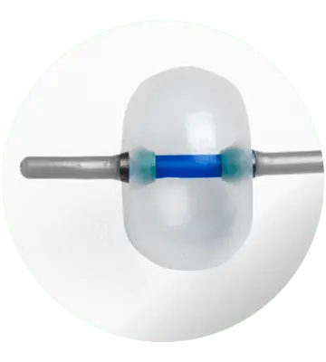 Balão Extrator de Cálculos