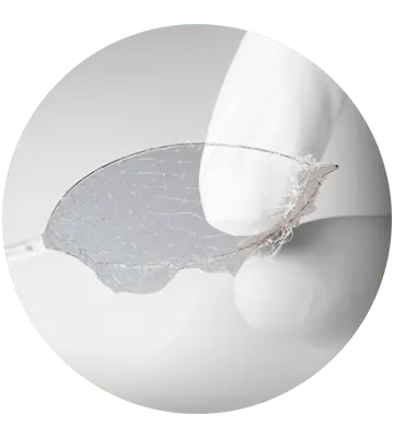 Cesta Retirada de Corpos Estranhos