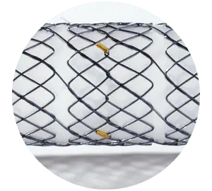 EPE - Parcial coberto - Hanaro Stent