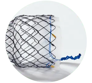 EPE - Parcial coberto - Hanaro Stent