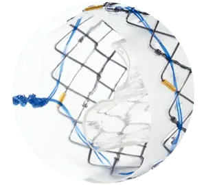 EPF - Parcial coberto com válvula - Hanaro Stent