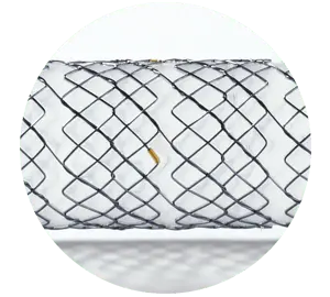 EPG – Parcial coberto com shim - Hanaro Stent