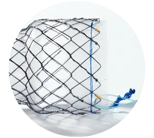 EPG – Parcial coberto com shim - Hanaro Stent