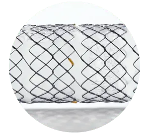 HEVT – Parcial coberto com válvula e shim - Hanaro Stent