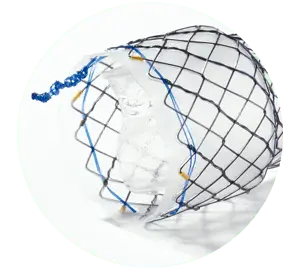 HEVT – Parcial coberto com válvula e shim - Hanaro Stent