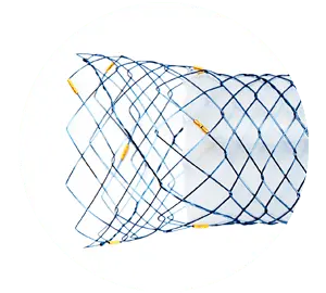 NDCL - Parcial coberto - Hanaro Stent