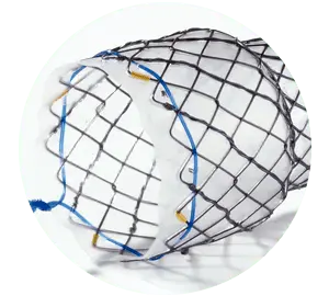 NES – Total coberto segmentado - Hanaro Stent