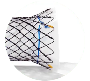 NESC – Total coberto cervical - Hanaro Stent