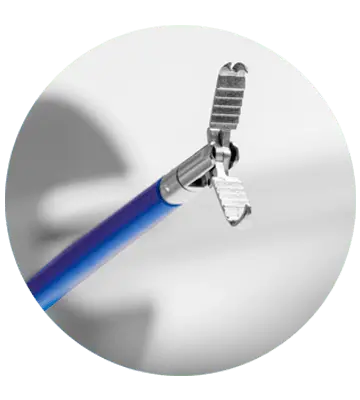 Pinça de Retirada de Corpo Estranho